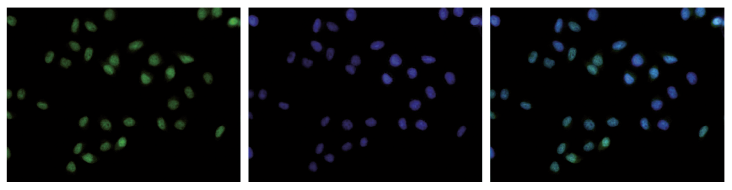 H3K36me3 Antibody for Immunofluorescence 