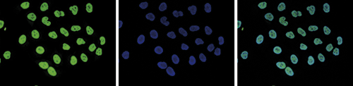 H3K4me1 Antibody validated for Immunofluorescence 