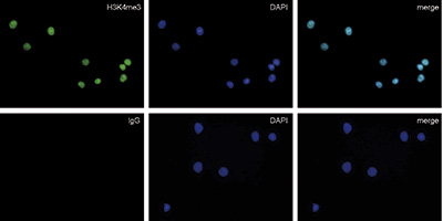 Rabbit IgG validated in Immunofluorescence