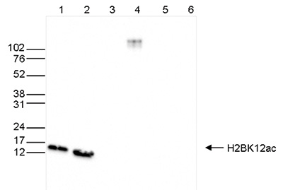 H2BK12ac Antibody validated in Western Blot