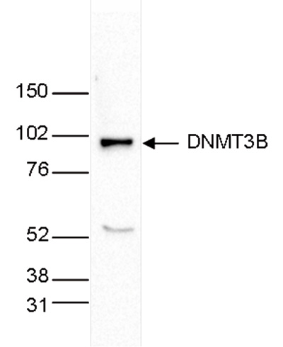 Western blot