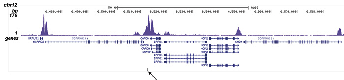 H2BK15ac Antibody validated in ChIP-seq