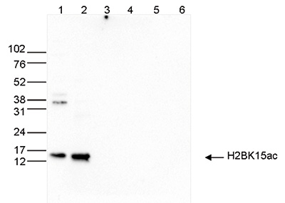 H2BK15ac Antibody validated in Western Blot