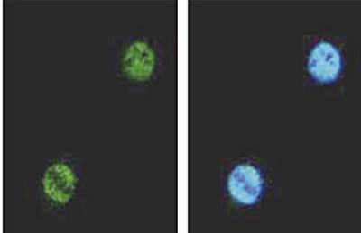 FOXA1 Antibody validated in Immunofluorescence