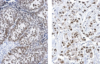 FOXA1 Antibody validated in Immunohistochemistry