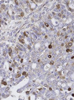 FOXM1 Antibody validated in Immunohistochemistry