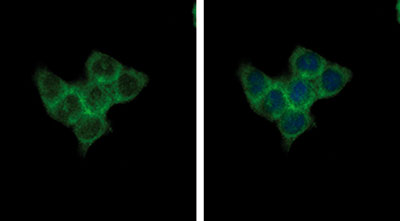 SMYD3 Antibody validated in Immunofluorescence