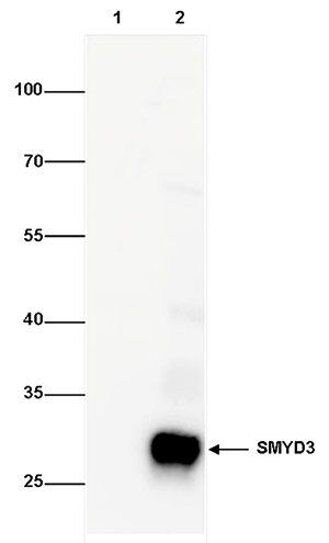 SMYD3 Antibody validated in Western Blot