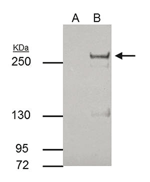 TET2 Antibody validated in Immunoprecipitates