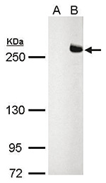 TET2 Antibody validated in Western Blot