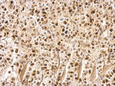 UHRF1 Antibody validated in immunohistochemical