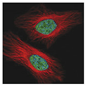 UHRF1 Antibody validated in immunofluorescence