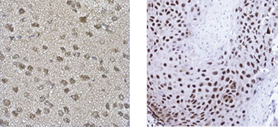 TARDBP Antibody validated in Immunohistochemistry 