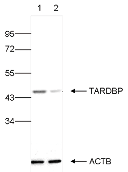 TARDBP Antibody validated in Western Blot