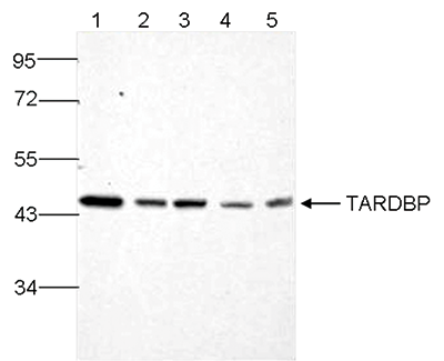 TARDBP Antibody validated in Western Blot 