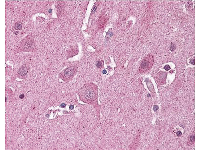 Immunohistochemistry