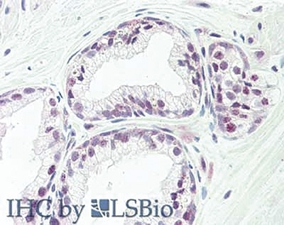 Immunohistochemistry