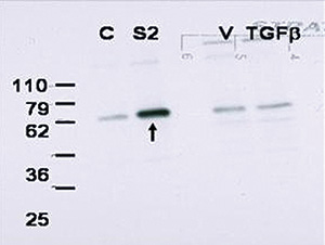 Western blot results