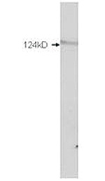 Western blot results