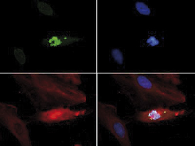 Immunofluorescence results