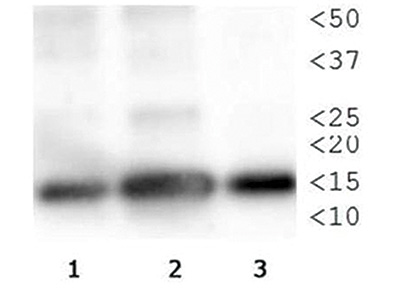 Western blot results