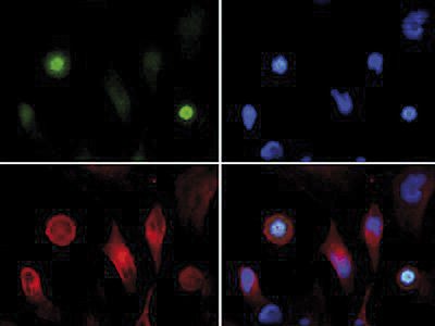 Immunofluorescence results