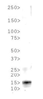 Western blot results