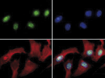 H3R8me2(asym) Antibody valiadted in Immunofluorescence