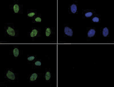 Immunofluorescence results