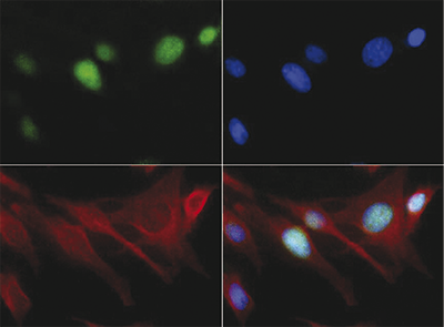 H3K18me1 Antibody validation in Immunofluorescence