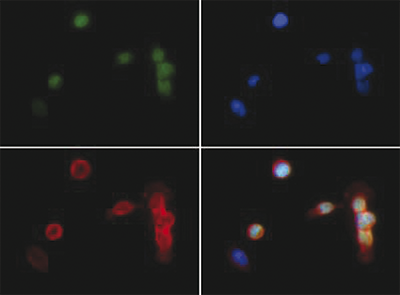 H3K18me2 Antibody validated in Immunofluorescence