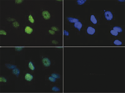 Immunofluorescence