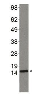 Western Blot