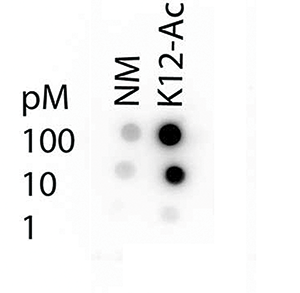 Dot blot results