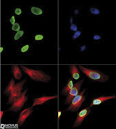 Immunofluorescence