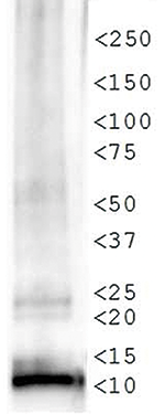 Western blot results