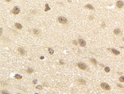 JMJD6 Antibody validated in Immunohistochemistry