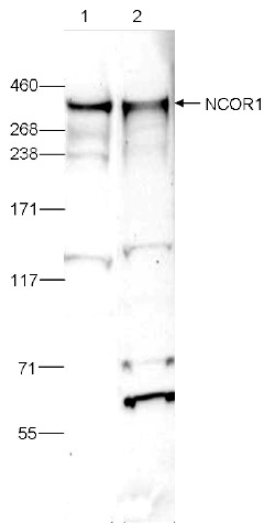 NCOR1 Antibody validated in Western Blot