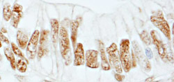 RBBP5 Antibody validated in Immunohistochemistry