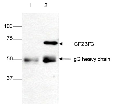 IP