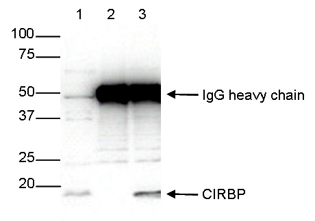 IP