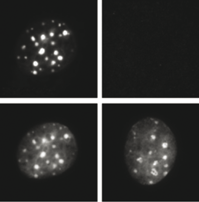 H3K9me3 Antibody validated in Immunofluorescence