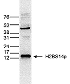 Western blot