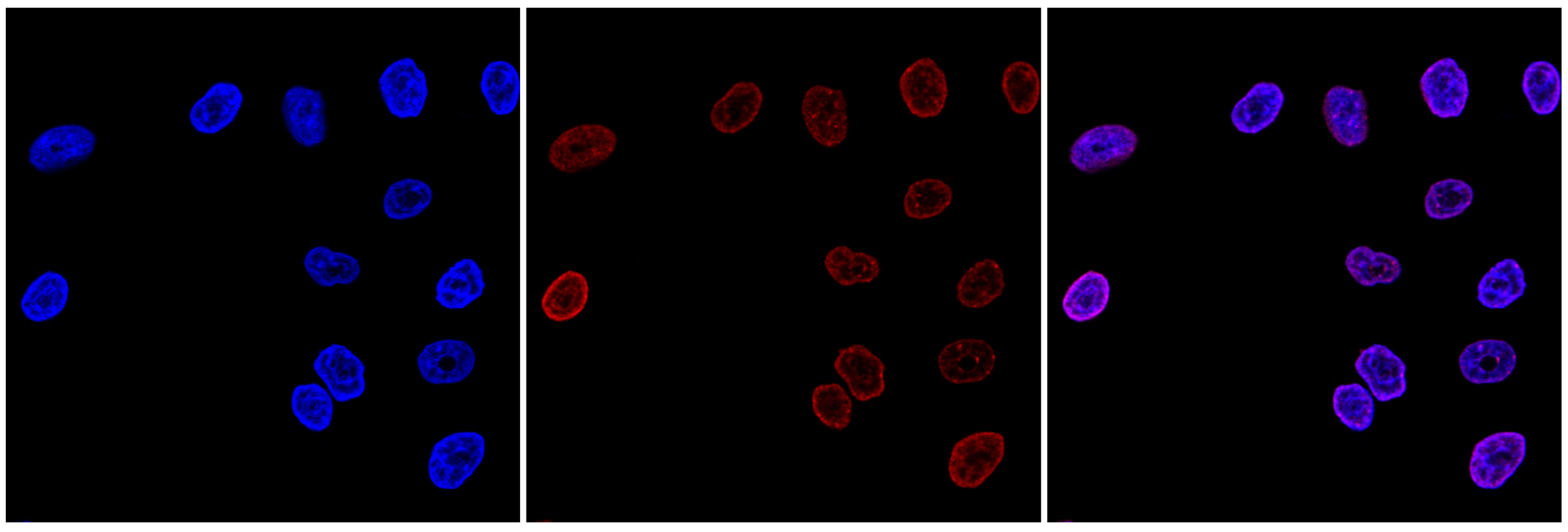 H3K9me3 Antibody validated in Immunofluorescence