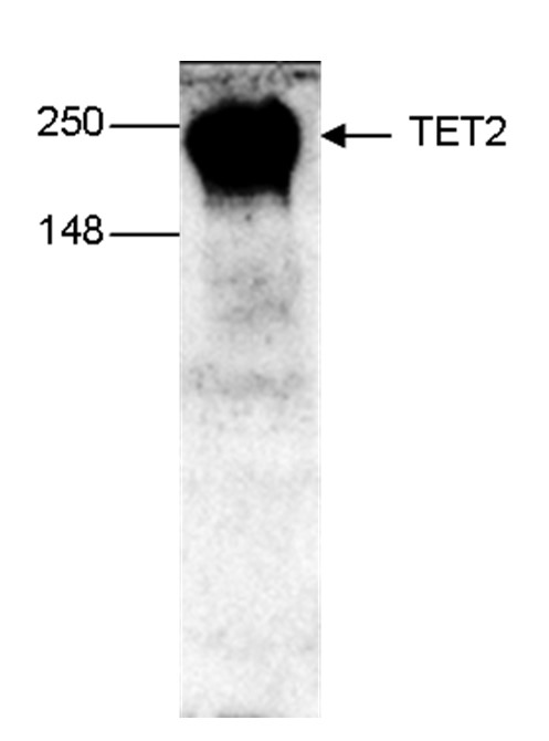 Western Blot