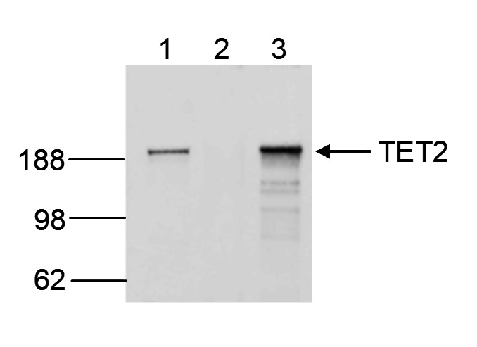 Immunoprecipitation