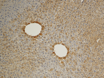 IHC