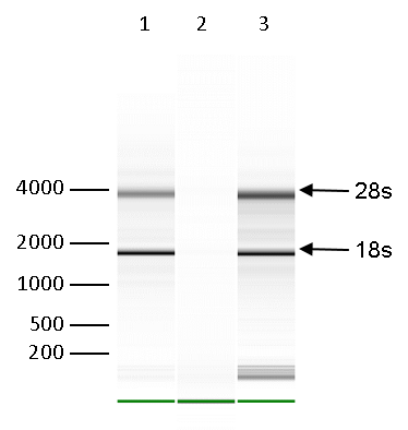 RNA immunoprecipitation