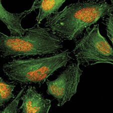 H2A.X Antibody validated in Immunofluorescence