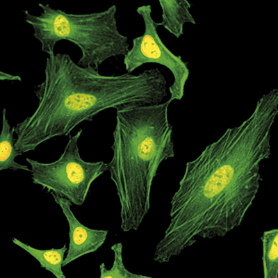 macroH2A.1/H2A.2 Antibody validated in Immunofluorescence